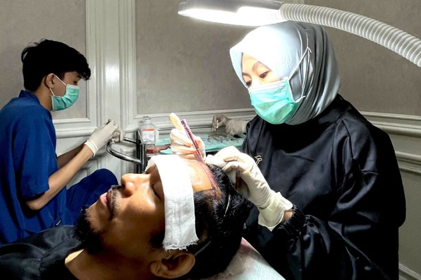 Indonesia Kembangkan Teknologi Hair Transplant Berstandar Internasional