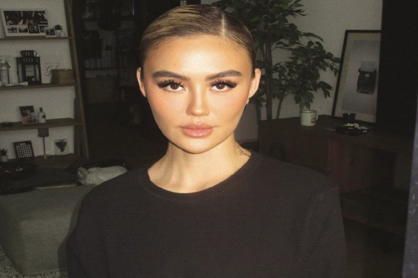 Profil Pendidikan Agnez Mo yang Harus Bayar Ganti Rugi Rp1,5 Miliar kepada Ari Bias